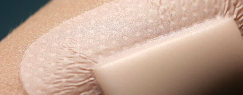 Adhesive Frames