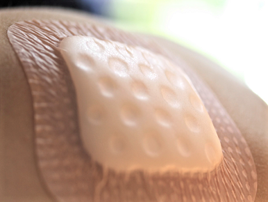 placeholder-image Advanced Wound Care