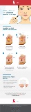 scapa-acne-hydrocolloids-infographic_v1